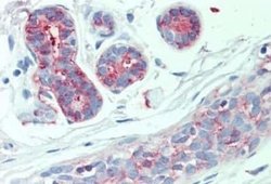 AE2 Antibody, Novus Biologicals 50 &mu;g; Unconjugated:Antibodies, Polyclonal